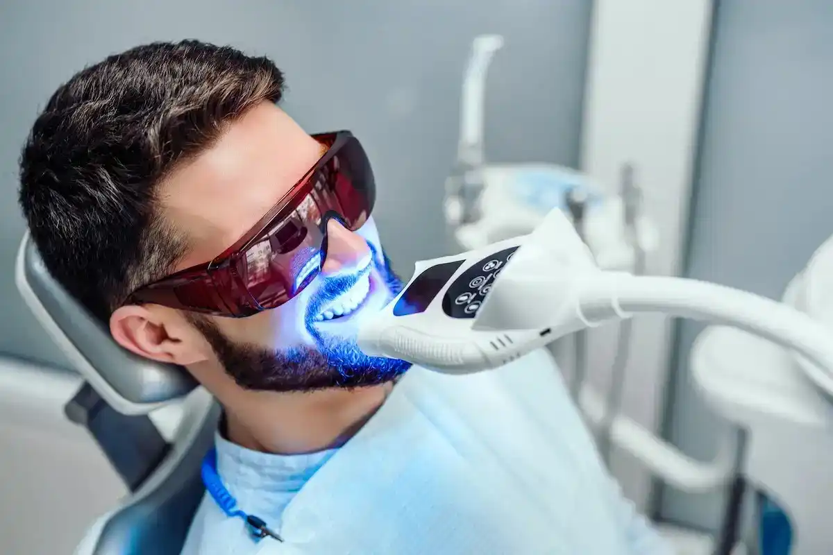 Close-up of Blue Light Teeth Whitening treatment in progress for a smiling man in a modern dental chair Buckhurst-Hill